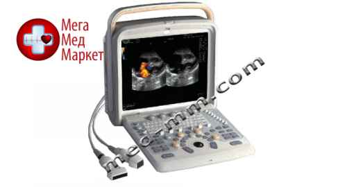 Купить УЗИ сканер Chison Q6 цена, характеристики, отзывы